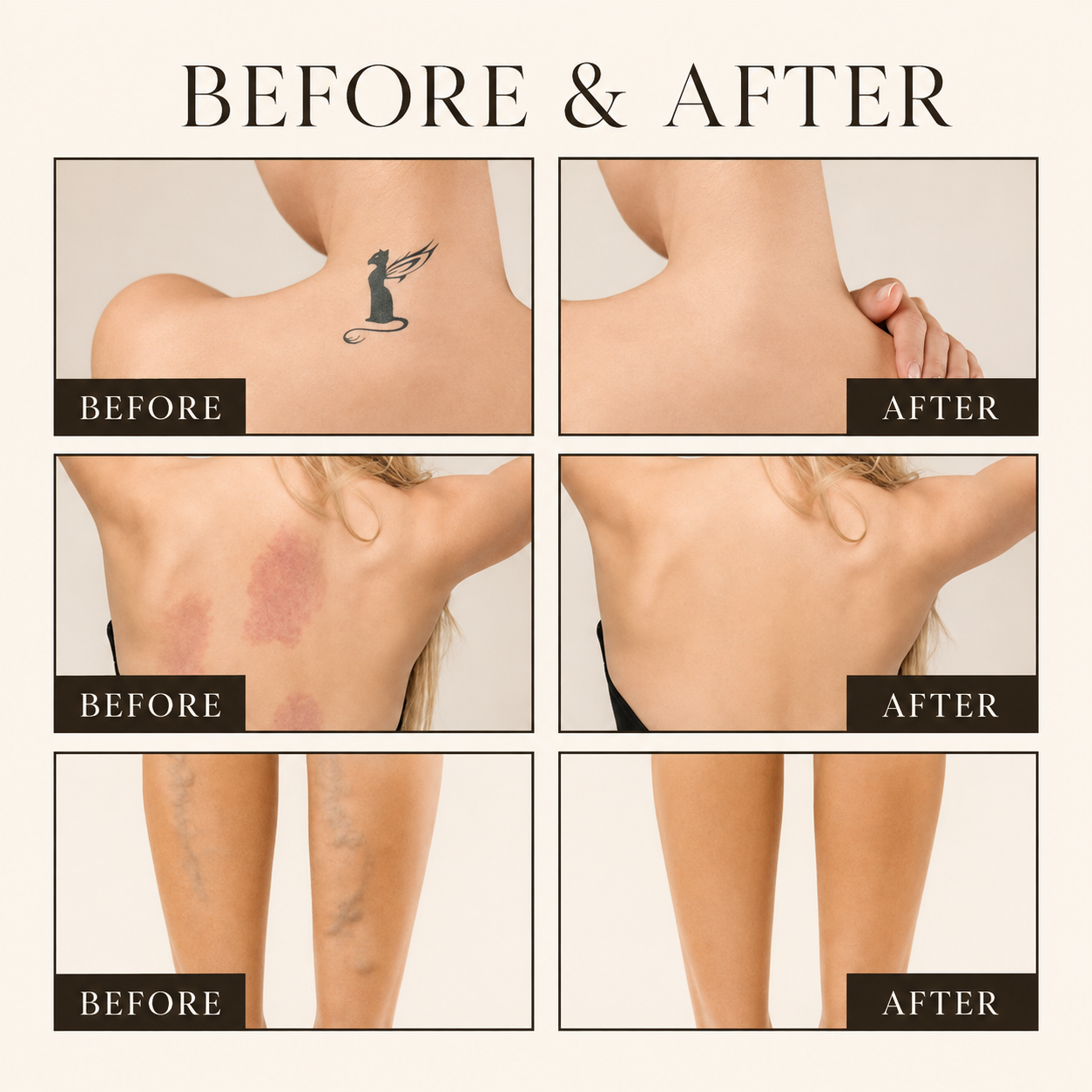 Body Perfector